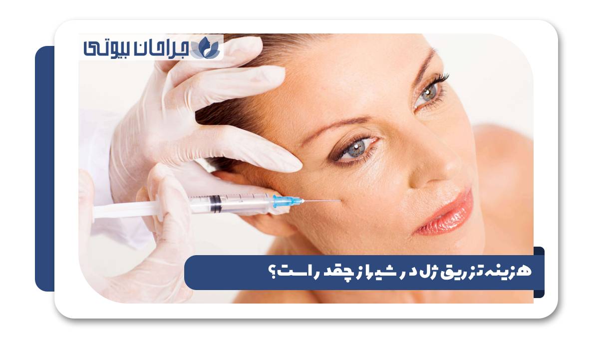 هزینه تزریق ژل در شیراز چقدر است؟