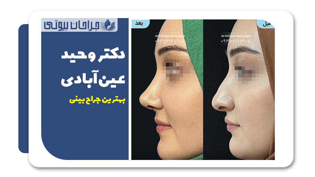 بهترین دکتر جراح بینی شیراز