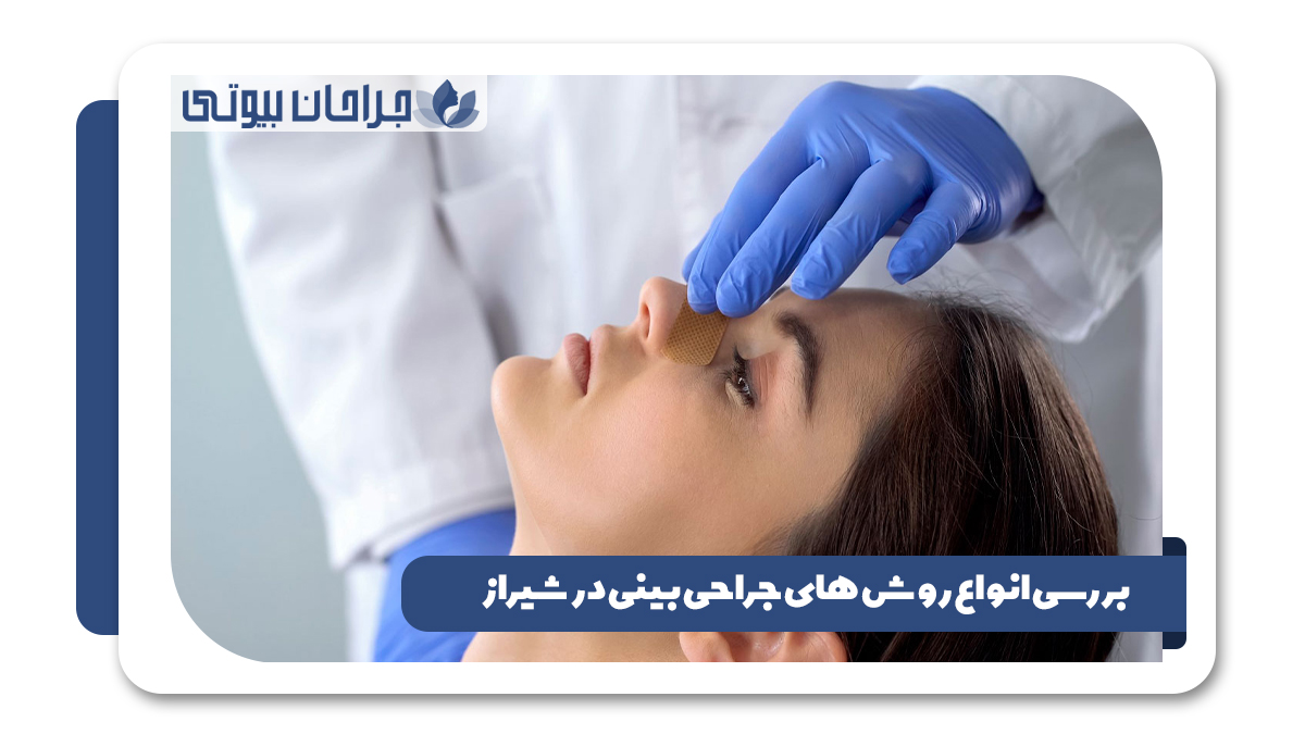 انواع روش های جراحی بینی در شیراز