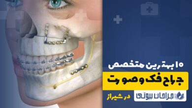 10 بهترین جراح فک و صورت در شیراز