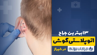 بهترین جراح اتوپلاستی در شیراز
