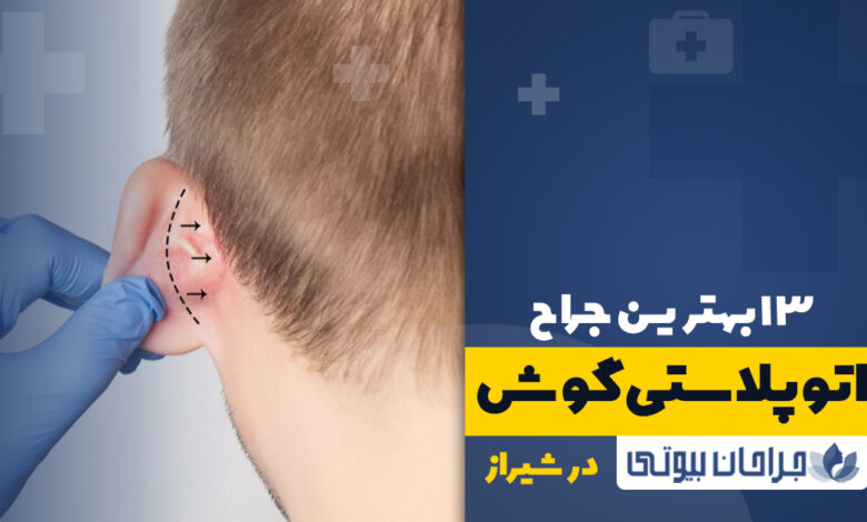 بهترین جراح اتوپلاستی در شیراز