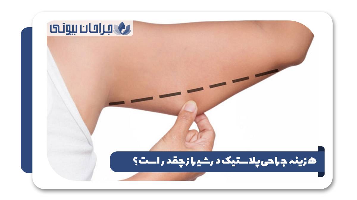 هزینه جراحی پلاستیک در شیراز چقدر است؟