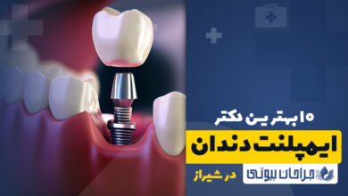 10 بهترین دکتر ایمپلنت در شیراز