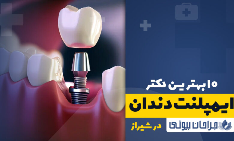 10 بهترین دکتر ایمپلنت در شیراز