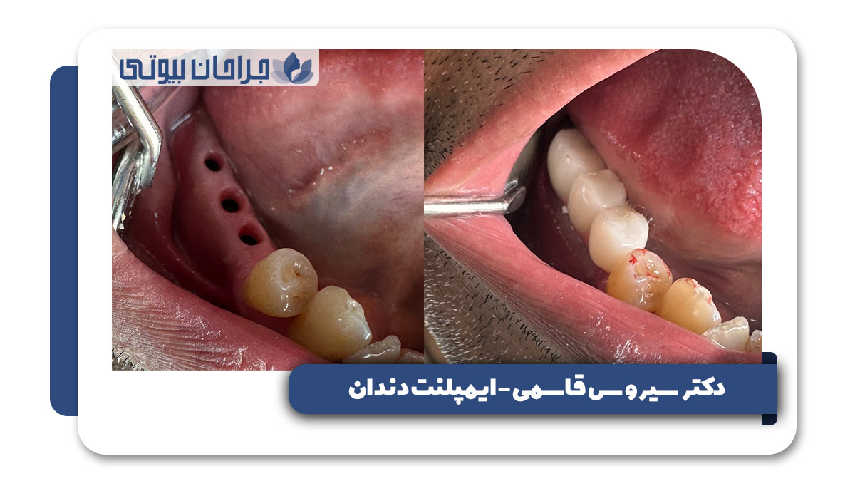 دکتر سیروس قاسمی