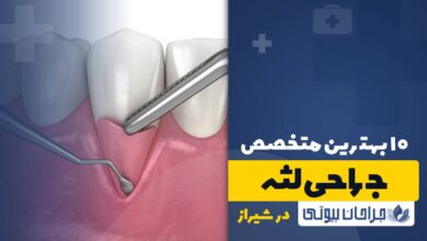 10 بهترین دکتر جراح لثه در شیراز