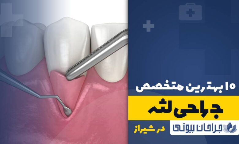 10 بهترین دکتر جراح لثه در شیراز