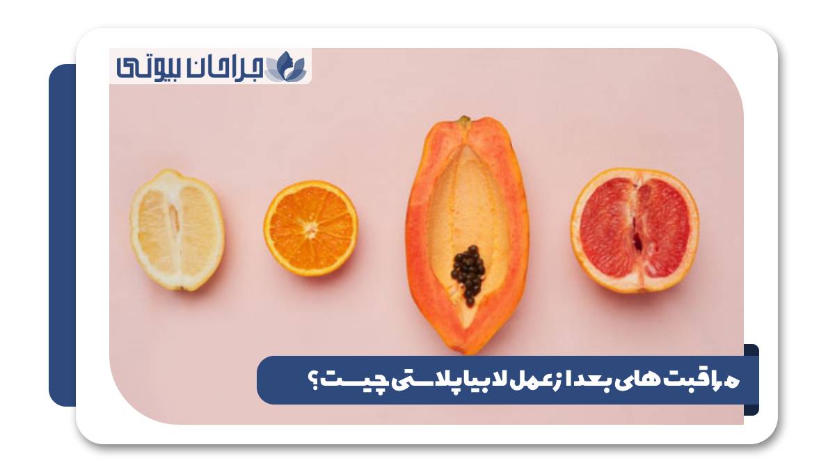 مراقبت های بعد از عمل لابیاپلاستی چیست؟