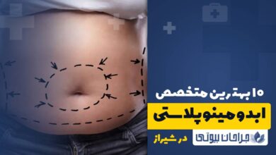 10 بهترین جراح ابدومینوپلاستی در شیراز