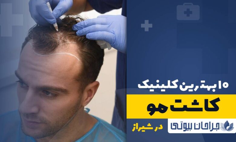10 بهترین کلینیک کاشت مو در شیراز