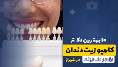 10 بهترین دکتر کامپوزیت دندان در شیراز