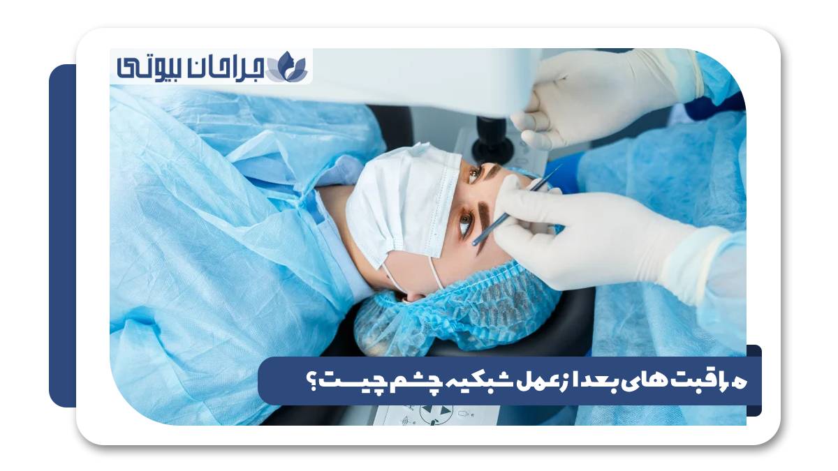 مراقبت های بعد از عمل شبکیه چشم چیست؟