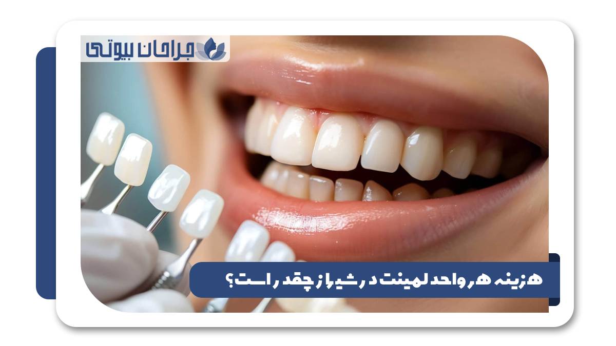 هزینه هر واحد لمینت در شیراز 