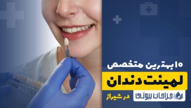 10 بهترین دکتر لمینت دندان در شیراز