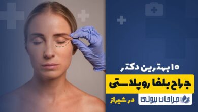 10 بهترین دکتر جراح بلفاروپلاستی در شیراز