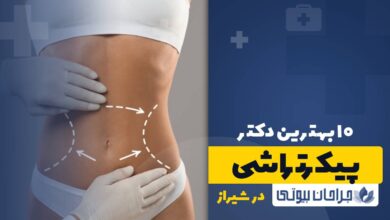 10 بهترین دکتر پیکرتراشی در شیراز