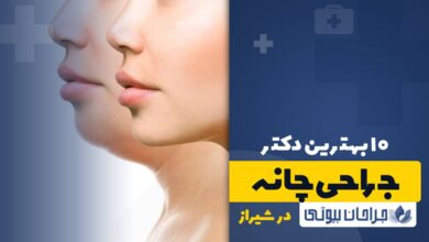 10 بهترین دکتر جراحی چانه در شیراز