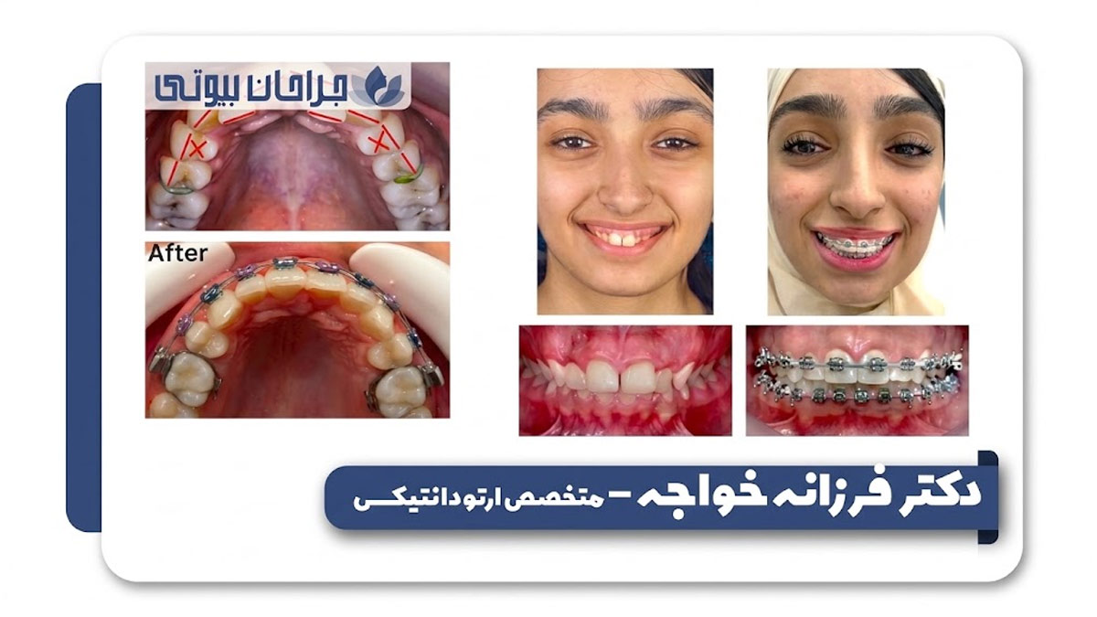 بهترین دکتر ارتودنسی در شیراز
