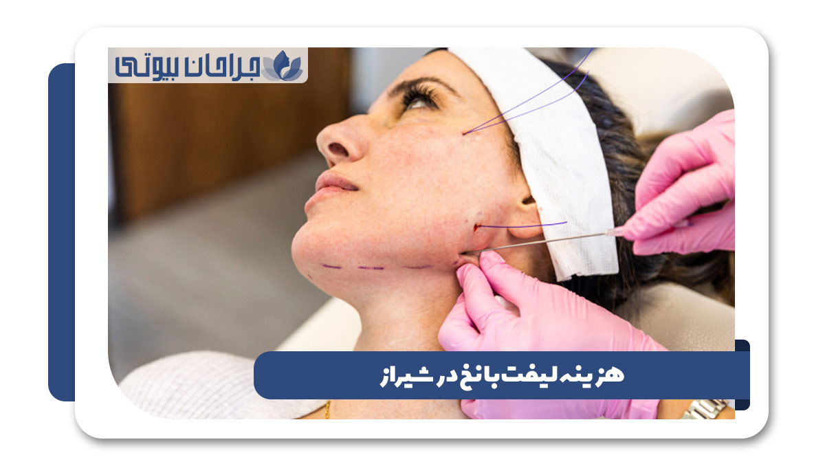 بهترین دکتر لیفت با نخ در شیراز