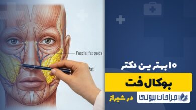 بهترین دکتر جراحی بوکال فت در شیراز