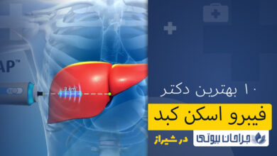 فیبرو اسکن کبد در شیراز
