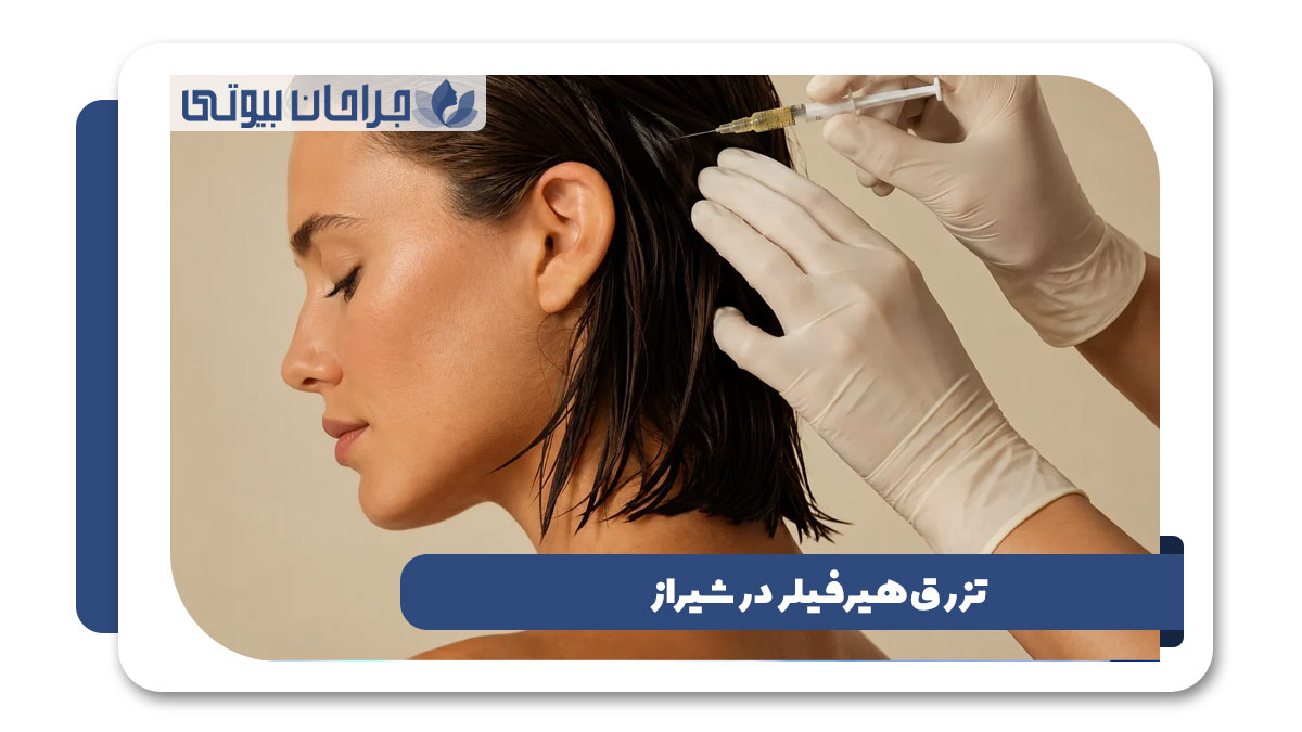 بهترین دکتر تزریق هیر فیلر در شیراز