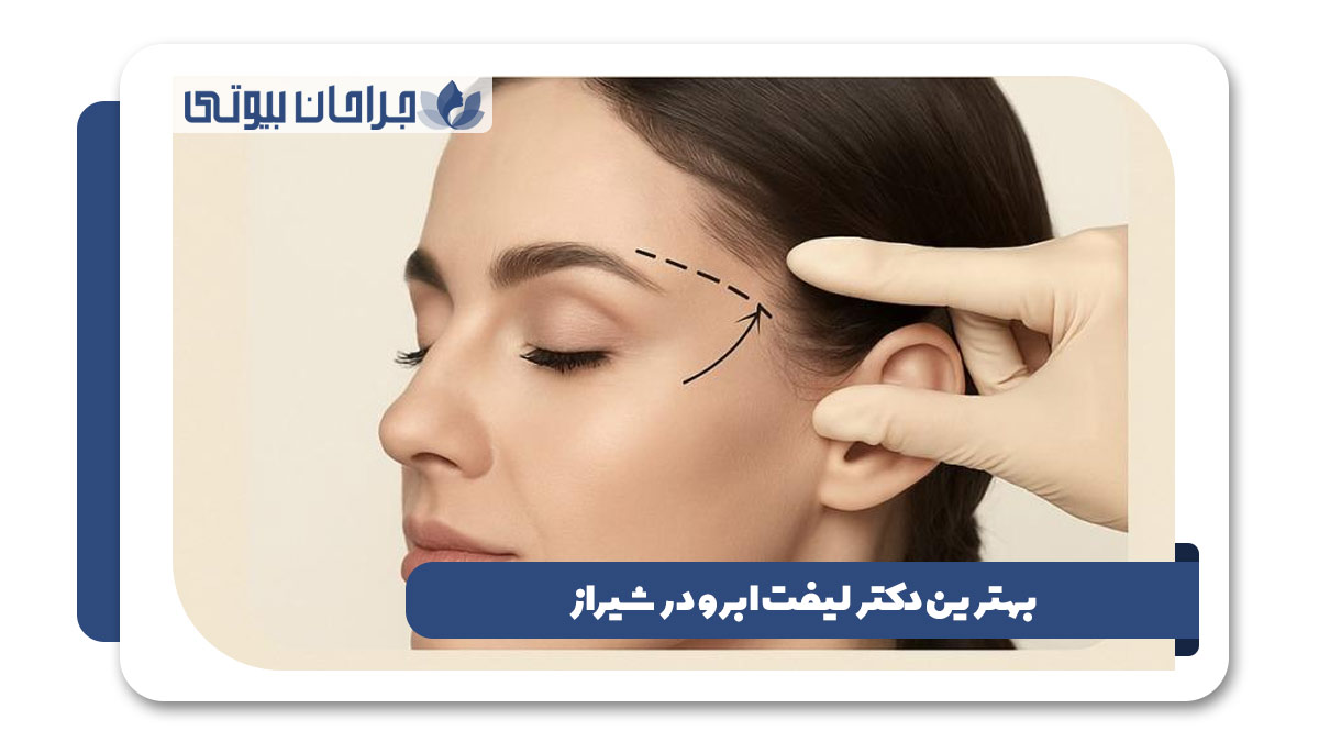 بهترین دکتر لیفت ابرو در شیراز