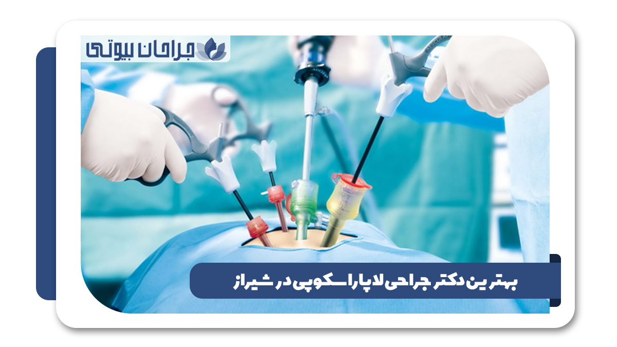 بهترین دکتر جراحی لاپاراسکوپی در شیراز