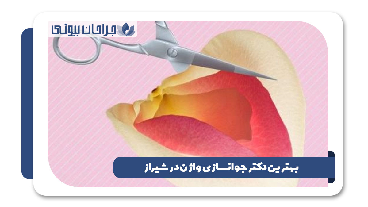 بهترین دکتر جوانسازی واژن در شیراز