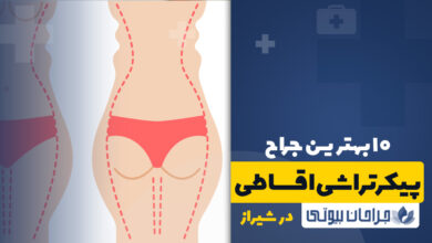 پیکرتراشی اقساطی در شیراز