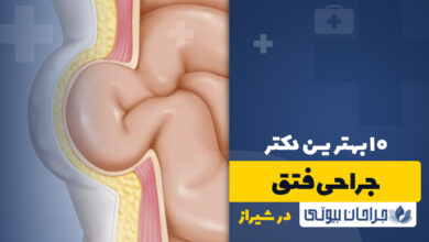 جراحی فتق در شیراز