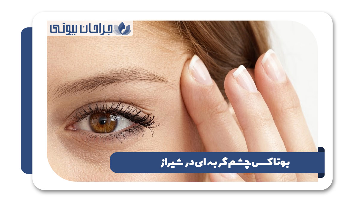 بوتاکس چشم گربه ای در شیراز
