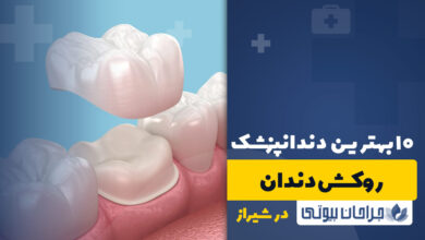 بهترین دکتر روکش دندان در شیراز