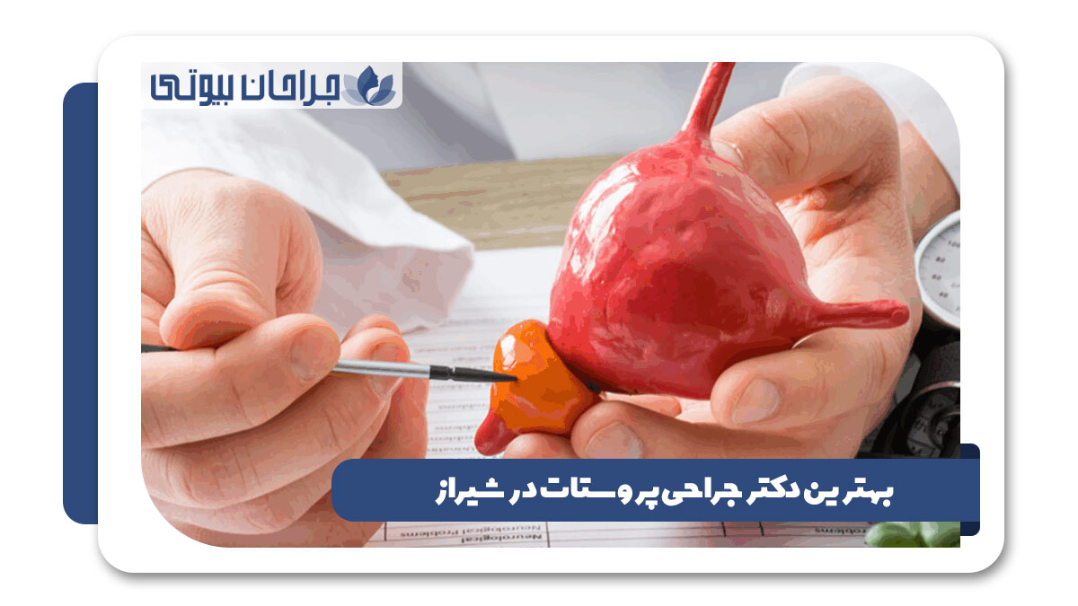 بهترین دکتر جراحی پروستات در شیراز