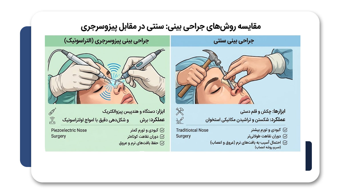 جراحی بینی با پیزوسرجری در شیراز