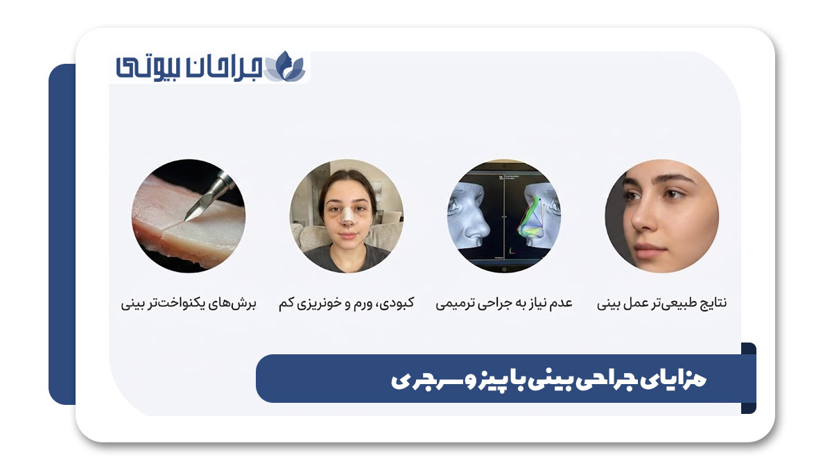 بهترین دکتر جراحی بینی با پیزوسرجری در شیراز
