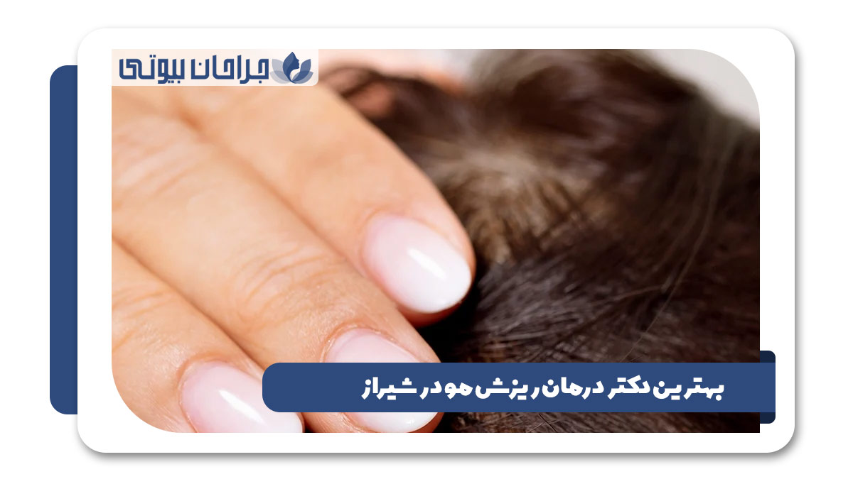 بهترین دکتر درمان ریزش مو در شیراز