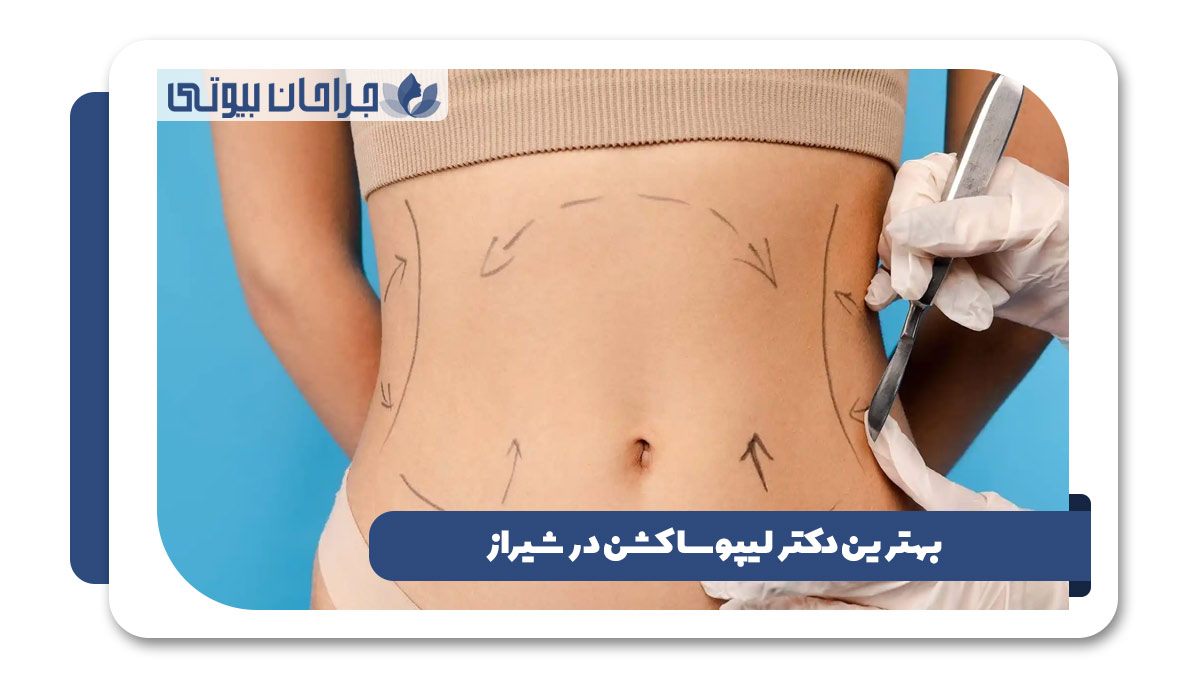 بهترین دکتر لیپوساکشن در شیراز