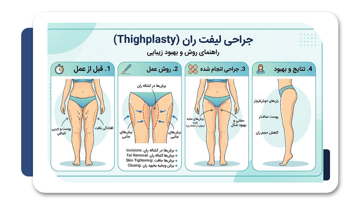 جراح لیفت ران در شیراز