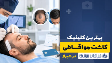 کلینیک کاشت مو اقساطی در شیراز