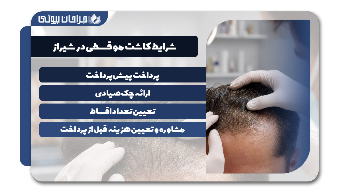 کلینیک کاشت مو اقساطی در شیراز