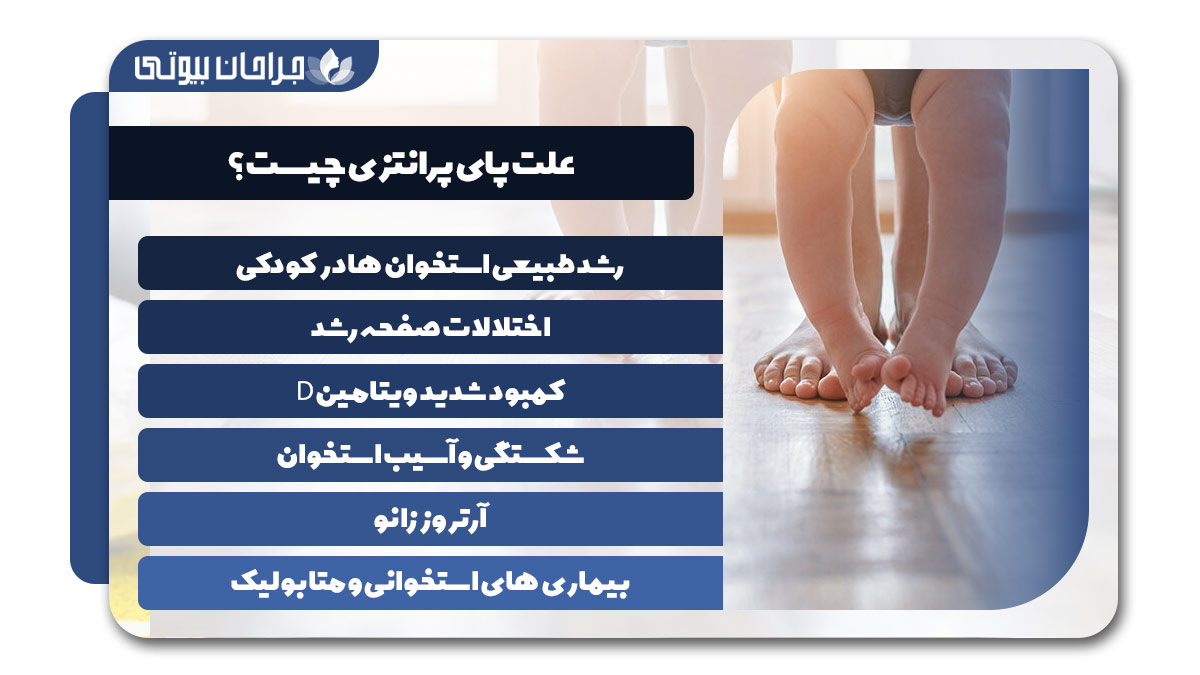  بهترین دکتر درمان پای پرانتزی در شیراز