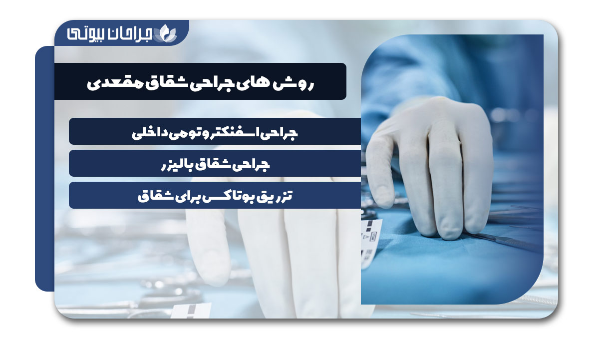 جراحی شقاق در شیراز